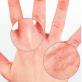Почему у ребенка на пальцах рук и ног облазит и шелушится кожа: причины и методы лечения