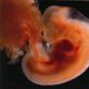 Сердцебиение плода - показатели нормы, методы контроля, патологии Сердцебиение ребенка на 6 неделе беременности